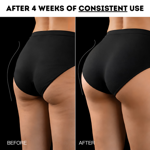 Imia™ EMS Booty Lift & Sculpting Shorts