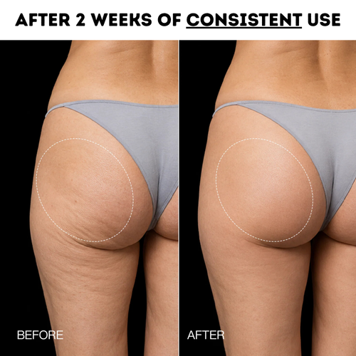 Imia™ EMS Booty Lift & Sculpting Shorts